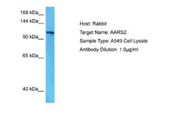 AARS2 Antibody, Novus Biologicals 100 &mu;L; Unconjugated:Antibodies, Polyclonal